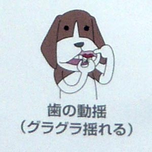 歯の動揺