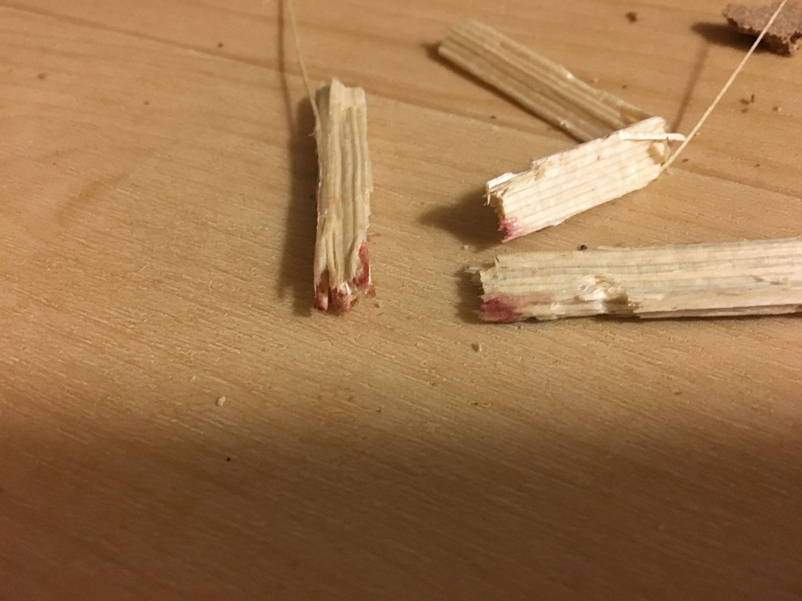 歯茎から血が出ませんか